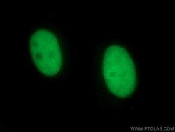 NSUN2 Mouse anti-Human, Clone: 2H5A2, Proteintech 150 &mu;L; Unconjugated:Antibodies,
