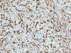 NSUN2 Mouse anti-Human, Clone: 2H5A2, Proteintech 150 &mu;L; Unconjugated:Antibodies,