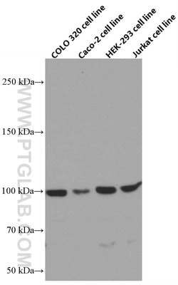 NSUN2 Mouse anti-Human, Clone: 2H5A2, Proteintech 150 &mu;L; Unconjugated:Antibodies,