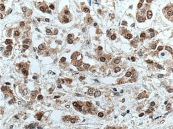 NSUN2 Mouse anti-Human, Clone: 2H5A2, Proteintech 150 &mu;L; Unconjugated:Antibodies,