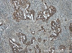 CHCHD5 Mouse anti-Human, Clone: 2G10A7, Proteintech:Antibodies:Primary