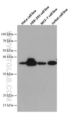 WBP2 Mouse anti-Human, Clone: 2B4G7, Proteintech 150 μL; Unconjugated:Antibodies,