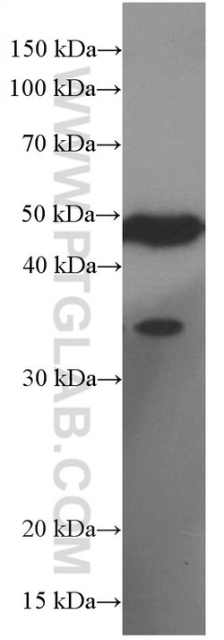 EGLN1 Mouse anti-Human, Mouse, Porcine, Rat, Clone: 1A2F1, Proteintech:Antibodies:Primary