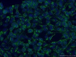 MRPL23 Mouse anti-Human, Clone: 1G11C4, Proteintech:Antibodies:Primary