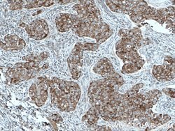 MRPL23 Mouse anti-Human, Clone: 1G11C4, Proteintech:Antibodies:Primary