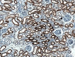 AGXT2 Mouse anti-Human, Mouse, Clone: 3A5B12, Proteintech:Antibodies:Primary