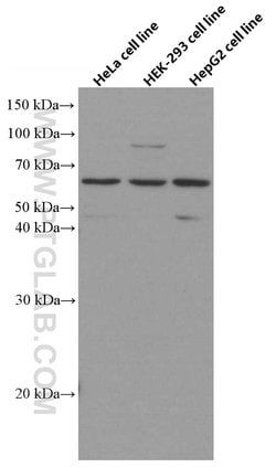 AGXT2 Mouse anti-Human, Mouse, Clone: 3A5B12, Proteintech:Antibodies:Primary