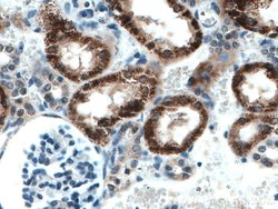 AGXT2 Mouse anti-Human, Mouse, Clone: 3A5B12, Proteintech:Antibodies:Primary