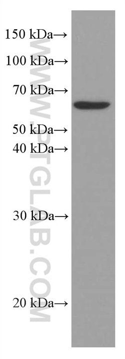 AGXT2 Mouse anti-Human, Mouse, Clone: 3A5B12, Proteintech:Antibodies:Primary