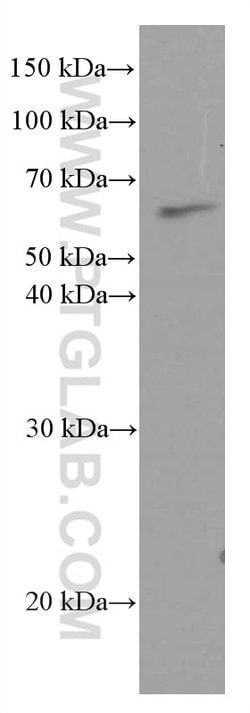 AGXT2 Mouse anti-Human, Mouse, Clone: 3A5B12, Proteintech:Antibodies:Primary