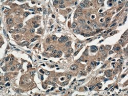 RANKL Mouse anti-Human, Clone: 3F2E1, Proteintech:Antibodies:Primary Antibodies