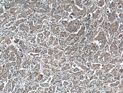 RANKL Mouse anti-Human, Clone: 3F2E1, Proteintech:Antibodies:Primary Antibodies