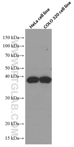 RANKL Mouse anti-Human, Clone: 3F2E1, Proteintech:Antibodies:Primary Antibodies