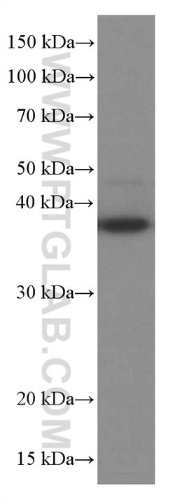 RANKL Mouse anti-Human, Clone: 3F2E1, Proteintech:Antibodies:Primary Antibodies