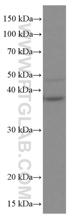RANKL Mouse anti-Human, Clone: 3F2E1, Proteintech:Antibodies:Primary Antibodies