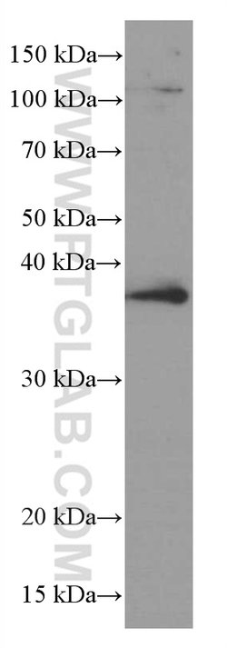 RANKL Mouse anti-Human, Clone: 3F2E1, Proteintech:Antibodies:Primary Antibodies