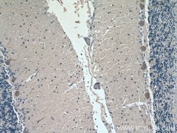 ACSL4 Mouse anti-Human, Clone: 1H5D3, Proteintech 150 &mu;L | Buy Online | Proteintech Group Inc | Fisher Scientific