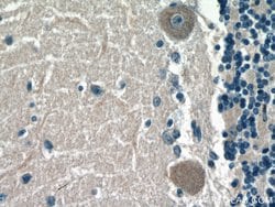 ACSL4 Mouse anti-Human, Clone: 1H5D3, Proteintech 150 &mu;L | Buy Online | Proteintech Group Inc | Fisher Scientific
