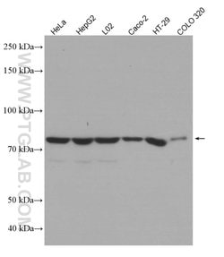 ACSL4 Mouse anti-Human, Clone: 1H5D3, Proteintech 150 &mu;L | Buy Online | Proteintech Group Inc | Fisher Scientific