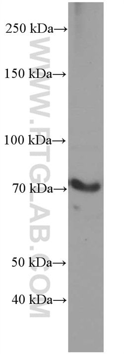 ACSL4 Mouse anti-Human, Clone: 1H5D3, Proteintech 150 &mu;L | Buy Online | Proteintech Group Inc | Fisher Scientific