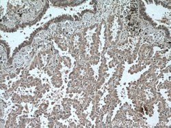 ADAM10 Mouse anti-Human, Clone: 2A6B7, Proteintech:Antibodies:Primary Antibodies