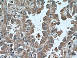 ADAM10 Mouse anti-Human, Clone: 2A6B7, Proteintech:Antibodies:Primary Antibodies