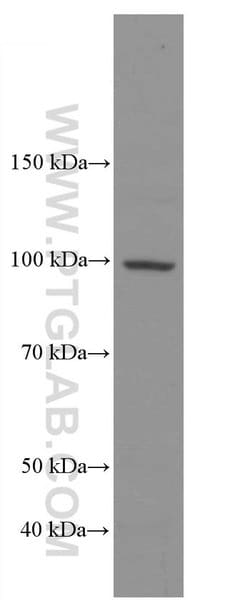ADAM10 Mouse anti-Human, Clone: 2A6B7, Proteintech:Antibodies:Primary Antibodies
