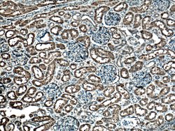 GSTA1 Mouse anti-Human, Mouse, Porcine, Rat, Clone: 1E1F4, Proteintech 150 &mu;L | Buy Online | Proteintech Group Inc | Fisher Scientific