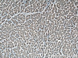 GSTA1 Mouse anti-Human, Mouse, Porcine, Rat, Clone: 1E1F4, Proteintech 150 &mu;L | Buy Online | Proteintech Group Inc | Fisher Scientific