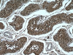 NEK2 Mouse anti-Human, Mouse, Rat, Clone: 3D7B4, Proteintech 150 &mu;L;