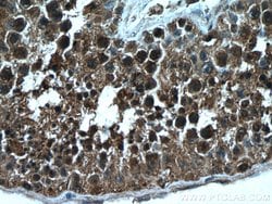 NEK2 Mouse anti-Human, Mouse, Rat, Clone: 3D7B4, Proteintech 150 &mu;L;