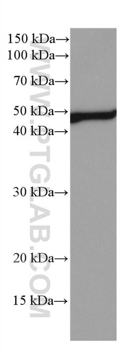 NEK2 Mouse anti-Human, Mouse, Rat, Clone: 3D7B4, Proteintech 150 &mu;L;