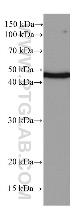 NEK2 Mouse anti-Human, Mouse, Rat, Clone: 3D7B4, Proteintech 150 &mu;L;