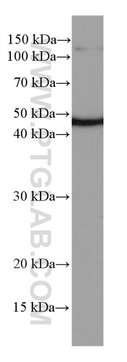 NEK2 Mouse anti-Human, Mouse, Rat, Clone: 3D7B4, Proteintech 150 &mu;L;