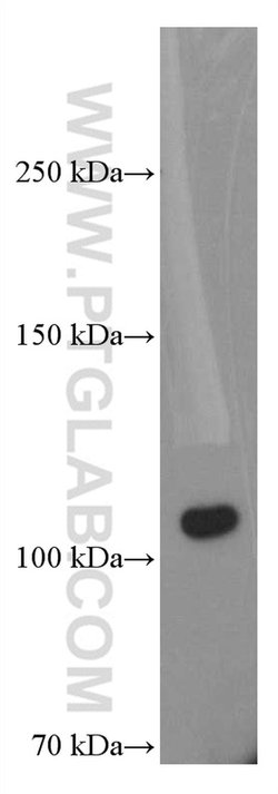 C5 Mouse anti-Human, Clone: 2G8C9, Proteintech:Antibodies:Primary Antibodies