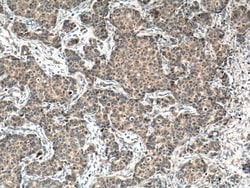 FIS1 Mouse anti-Human, Clone: 2F10E1, Proteintech:Anticuerpos:Anticuerpos