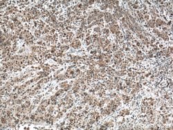FIS1 Mouse anti-Human, Clone: 2F10E1, Proteintech:Anticuerpos:Anticuerpos