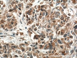 FIS1 Mouse anti-Human, Clone: 2F10E1, Proteintech:Anticuerpos:Anticuerpos