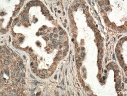 FIS1 Mouse anti-Human, Clone: 2F10E1, Proteintech:Anticuerpos:Anticuerpos