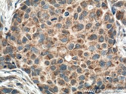 FIS1 Mouse anti-Human, Clone: 2F10E1, Proteintech:Anticuerpos:Anticuerpos