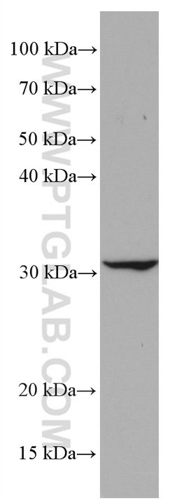 CD302 Mouse anti-Human, Mouse, Clone: 2B1E8, Proteintech:Antibodies:Primary
