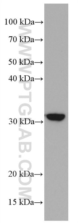 CD302 Mouse anti-Human, Mouse, Clone: 2B1E8, Proteintech:Antibodies:Primary