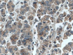 GRASP65/GORASP1 Mouse anti-Human, Mouse, Rat, Clone: 1B2C10, Proteintech:Antibodies:Primary