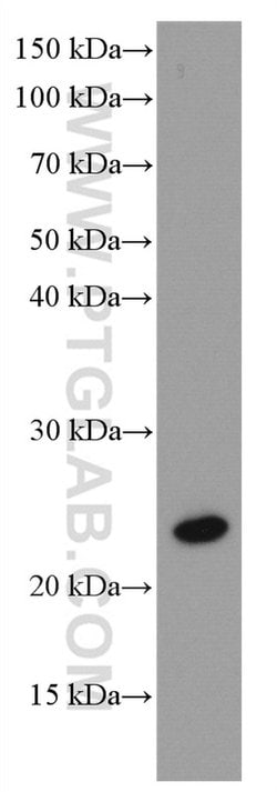 RAB43 Mouse anti-Human, Clone: 3B2A8, Proteintech:Antibodies:Primary Antibodies