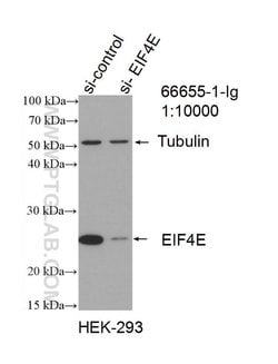EIF4E Mouse anti-Human, Mouse, Rat, Clone: 3C6B9, Proteintech 150 &mu;L;