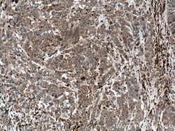STK4 Mouse anti-Human, Mouse, Rat, Clone: 2G11C1, Proteintech:Antibodies:Primary