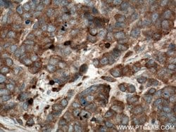STK4 Mouse anti-Human, Mouse, Rat, Clone: 2G11C1, Proteintech:Antibodies:Primary