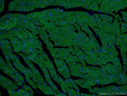 Beclin 1 Mouse anti-Human, Mouse, Rat, Clone: 1C10C4, Proteintech 150 &mu;L | Buy Online | Proteintech Group Inc | Fisher Scientific