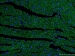 Beclin 1 Mouse anti-Human, Mouse, Rat, Clone: 1C10C4, Proteintech 150 &mu;L | Buy Online | Proteintech Group Inc | Fisher Scientific