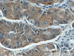 Beclin 1 Mouse anti-Human, Mouse, Rat, Clone: 1C10C4, Proteintech 150 &mu;L | Buy Online | Proteintech Group Inc | Fisher Scientific
